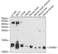 Western blot analysis of extracts of various cell lines, using COX6B1 antibody  at 1:1000 dilution.
Secondary antibody: HRP…