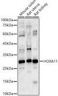 Western blot analysis of various lysates, using HOXA11 antibody  at 1:1050 dilution.
Secondary antibody: HRP Goat Anti-Rabbit IgG   at 1:10000 dilution.
Lysates/proteins: 25ug per lane.
Blocking buffer: 3% nonfat dry milk in TBST.
Detection: ECL Basic Kit .
Exposure time: 60s.