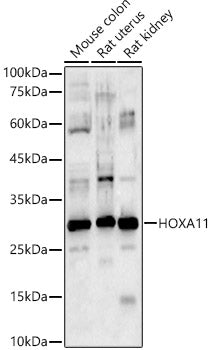 Western blot analysis of various lysates, using HOXA11 antibody  at 1:1050 dilution.
Secondary antibody: HRP Goat Anti-Rabbit IgG   at 1:10000 dilution.
Lysates/proteins: 25ug per lane.
Blocking buffer: 3% nonfat dry milk in TBST.
Detection: ECL Basic Kit .
Exposure time: 60s.
