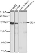 Western blot analysis of extracts of various cell lines, using EIF3A antibody  at 1:1000 dilution.
Secondary antibody: HRP Goat Anti-Rabbit IgG   at 1:10000 dilution.
Lysates/proteins: 25ug per lane.
Blocking buffer: 3% nonfat dry milk in TBST.
Detection: ECL Basic Kit .
Exposure time: 30s.