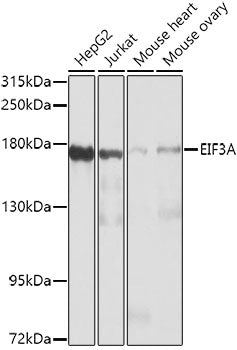 Western blot analysis of extracts of various cell lines, using EIF3A antibody  at 1:1000 dilution.
Secondary antibody: HRP Goat Anti-Rabbit IgG   at 1:10000 dilution.
Lysates/proteins: 25ug per lane.
Blocking buffer: 3% nonfat dry milk in TBST.
Detection: ECL Basic Kit .
Exposure time: 30s.