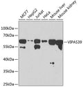 Western blot analysis of extracts of various cell lines, using VIPAS39 antibody  at 1:1000 dilution.
Secondary antibody…