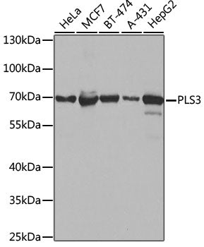PLS3 polyclonal antibody – Figure 1 of 1