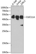 Western blot analysis of extracts of various cell lines, using CLEC11A antibody  at 1:1000 dilution.
Secondary antibody…