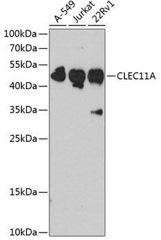 Western blot analysis of extracts of various cell lines, using CLEC11A antibody  at 1:1000 dilution.
Secondary antibody…