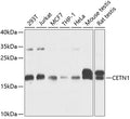 Western blot analysis of extracts of various cell lines, using CETN1 antibody  at 1:1000 dilution.
Secondary antibody: HRP Goat Anti-Rabbit IgG   at 1:10000 dilution.
Lysates/proteins: 25ug per lane.
Blocking buffer: 3% nonfat dry milk in TBST.
Detection: ECL Basic Kit .
Exposure time: 10s.