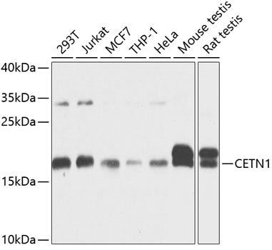 Western blot analysis of extracts of various cell lines, using CETN1 antibody  at 1:1000 dilution.
Secondary antibody: HRP Goat Anti-Rabbit IgG   at 1:10000 dilution.
Lysates/proteins: 25ug per lane.
Blocking buffer: 3% nonfat dry milk in TBST.
Detection: ECL Basic Kit .
Exposure time: 10s.