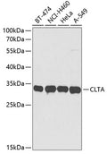 Western blot analysis of extracts of various cell lines, using CLTA antibody  at 1:3000 dilution.
Secondary antibody: HRP…
