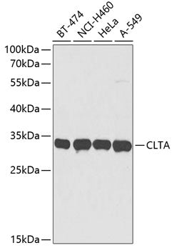 Western blot analysis of extracts of various cell lines, using CLTA antibody  at 1:3000 dilution.
Secondary antibody: HRP…