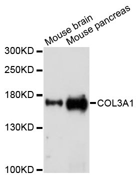 Western blot analysis of extracts of Mouse brain, using Collagen III alpha 1/COL3A1 Rabbit pAb  at 1:1000…