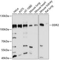 DDR2 polyclonal antibody – Figure 1 of 1