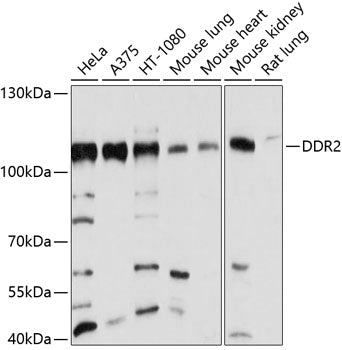 DDR2 polyclonal antibody – Figure 1 of 1