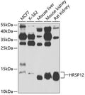 Western blot analysis of extracts of various cell lines, using HRSP12 antibody  at 1:1000 dilution.
Secondary antibody: HRP Goat Anti-Rabbit IgG   at 1:10000 dilution.
Lysates/proteins: 25ug per lane.
Blocking buffer: 3% nonfat dry milk in TBST.
Detection: ECL Basic Kit .
Exposure time: 90s.