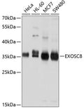 Western blot analysis of extracts of various cell lines, using EXOSC8 antibody  at 1:1000 dilution.
Secondary antibody: HRP Goat Anti-Rabbit IgG   at 1:10000 dilution.
Lysates/proteins: 25ug per lane.
Blocking buffer: 3% nonfat dry milk in TBST.
Detection: ECL Basic Kit .
Exposure time: 1s.