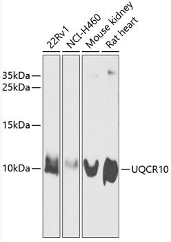 Western blot analysis of extracts of various cell lines, using UQCR10 antibody  at 1:1000 dilution.
Secondary antibody: HRP Goat Anti-Rabbit IgG   at 1:10000 dilution.
Lysates/proteins: 25ug per lane.
Blocking buffer: 3% nonfat dry milk in TBST.
Detection: ECL Enhanced Kit .
Exposure time: 30s.