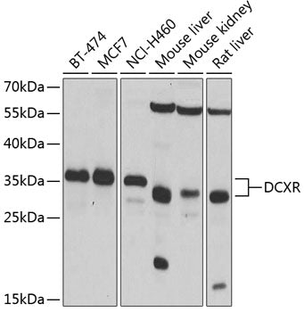 Western blot analysis of extracts of various cell lines, using DCXR antibody.