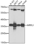 Western blot analysis of extracts of various cell lines, using MRPL1 antibody  at 1:1000 dilution.
Secondary antibody: HRP Goat Anti-Rabbit IgG   at 1:10000 dilution.
Lysates/proteins: 25ug per lane.
Blocking buffer: 3% nonfat dry milk in TBST.
Detection: ECL Basic Kit .
Exposure time: 10s.