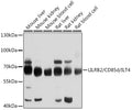 Western blot analysis of extracts of various cell lines, using LILRB2/CD85d/ILT4 antibody  at 1:1000 dilution.
Secondary antibody: HRP Goat Anti-Rabbit IgG   at 1:10000 dilution.
Lysates/proteins: 25ug per lane.
Blocking buffer: 3% nonfat dry milk in TBST.
Detection: ECL Basic Kit .
Exposure time: 5s.