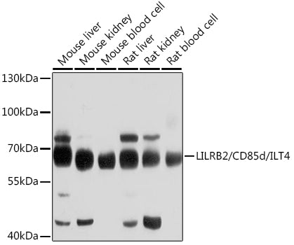 Western blot analysis of extracts of various cell lines, using LILRB2/CD85d/ILT4 antibody  at 1:1000 dilution.
Secondary antibody: HRP Goat Anti-Rabbit IgG   at 1:10000 dilution.
Lysates/proteins: 25ug per lane.
Blocking buffer: 3% nonfat dry milk in TBST.
Detection: ECL Basic Kit .
Exposure time: 5s.