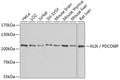 ALIX / PDCD6IP polyclonal antibody - Figure 1 of 1