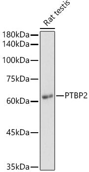 Western blot analysis of extracts of Rat testis, using PTBP2  antibody  at 1:1000 dilution.
Secondary antibody: HRP Goat Anti-Rabbit IgG   at 1:10000 dilution.
Lysates/proteins: 25ug per lane.
Blocking buffer: 3% nonfat dry milk in TBST.
Detection: ECL Basic Kit .
Exposure time: 10s.