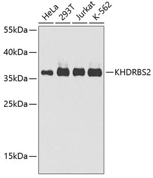 Western blot analysis of extracts of various cell lines, using KHDRBS2 antibody  at 1:1000 dilution.
Secondary antibody…