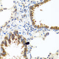 Immunohistochemistry of paraffin-embedded rat lung using C8orf4 antibody  at dilution of 1:100 .Perform microwave antigen retrieval with 10 mM PBS buffer pH 7.2 before commencing with IHC staining protocol.