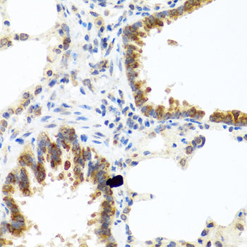 Immunohistochemistry of paraffin-embedded rat lung using C8orf4 antibody  at dilution of 1:100 .Perform microwave antigen retrieval with 10 mM PBS buffer pH 7.2 before commencing with IHC staining protocol.