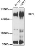 Western blot analysis of extracts of various cell lines, using BRIP1 antibody  at 1:1000 dilution.
Secondary antibody: HRP Goat Anti-Rabbit IgG   at 1:10000 dilution.
Lysates/proteins: 25ug per lane.
Blocking buffer: 3% nonfat dry milk in TBST.
Detection: ECL Basic Kit .
Exposure time: 30s.