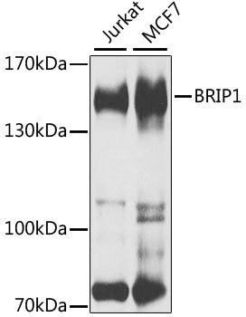Western blot analysis of extracts of various cell lines, using BRIP1 antibody  at 1:1000 dilution.
Secondary antibody: HRP Goat Anti-Rabbit IgG   at 1:10000 dilution.
Lysates/proteins: 25ug per lane.
Blocking buffer: 3% nonfat dry milk in TBST.
Detection: ECL Basic Kit .
Exposure time: 30s.