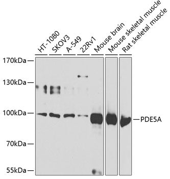 Western blot analysis of extracts of various cell lines, using PDE5A antibody  at 1:1000 dilution.
Secondary antibody: HRP Goat Anti-Rabbit IgG   at 1:10000 dilution.
Lysates/proteins: 25ug per lane.
Blocking buffer: 3% nonfat dry milk in TBST.
Detection: ECL Basic Kit .
Exposure time: 60s.