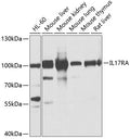 Western blot analysis of extracts of various cell lines, using IL17RA antibody  at 1:1000 dilution.
Secondary antibody: HRP Goat Anti-Rabbit IgG   at 1:10000 dilution.
Lysates/proteins: 25ug per lane.
Blocking buffer: 3% nonfat dry milk in TBST.
Detection: ECL Basic Kit .
Exposure time: 5s.