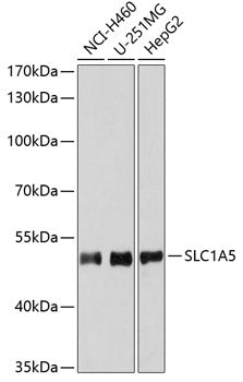 Western blot analysis of extracts of various cell lines, using SLC1A5 antibody  at 1:1000 dilution.
Secondary antibody: HRP Goat Anti-Rabbit IgG   at 1:10000 dilution.
Lysates/proteins: 25ug per lane.
Blocking buffer: 3% nonfat dry milk in TBST.
Detection: ECL Basic Kit .
Exposure time: 180s.