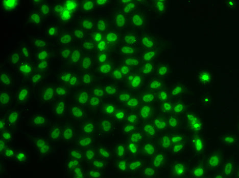 Immunohistochemistry of paraffin-embedded human kidney using TOX Rabbit pAb  at dilution of 1:50 .Perform high pressure antigen retrieval with 10 mM citrate buffer pH 6.0 before commencing with IHC staining protocol.