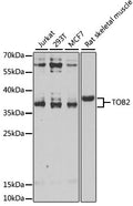 Western blot analysis of extracts of various cell lines, using TOB2 antibody  at 1:1000 dilution.
Secondary antibody: HRP Goat Anti-Rabbit IgG   at 1:10000 dilution.
Lysates/proteins: 25ug per lane.
Blocking buffer: 3% nonfat dry milk in TBST.
Detection: ECL Enhanced Kit .
Exposure time: 30s.