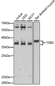 Western blot analysis of extracts of various cell lines, using TOB2 antibody  at 1:1000 dilution.
Secondary antibody: HRP Goat Anti-Rabbit IgG   at 1:10000 dilution.
Lysates/proteins: 25ug per lane.
Blocking buffer: 3% nonfat dry milk in TBST.
Detection: ECL Enhanced Kit .
Exposure time: 30s.