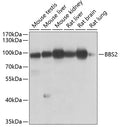Western blot analysis of extracts of various cell lines, using BBS2 antibody  at 1:1000 dilution.
Secondary antibody: HRP…