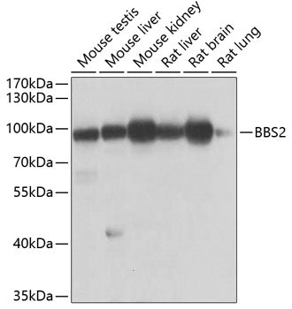 Western blot analysis of extracts of various cell lines, using BBS2 antibody  at 1:1000 dilution.
Secondary antibody: HRP…