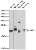 Western blot analysis of extracts of various cell lines, using RAB31 antibody  at 1:1000 dilution.
Secondary antibody: HRP Goat Anti-Rabbit IgG   at 1:10000 dilution.
Lysates/proteins: 25ug per lane.
Blocking buffer: 3% nonfat dry milk in TBST.
Detection: ECL Basic Kit .
Exposure time: 30s.