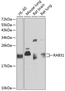 Western blot analysis of extracts of various cell lines, using RAB31 antibody  at 1:1000 dilution.
Secondary antibody: HRP Goat Anti-Rabbit IgG   at 1:10000 dilution.
Lysates/proteins: 25ug per lane.
Blocking buffer: 3% nonfat dry milk in TBST.
Detection: ECL Basic Kit .
Exposure time: 30s.
