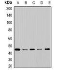 Western blot analysis of extracts of various cell lines, using CYP2F1 antibody.
