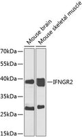 Western blot analysis of extracts of various cell lines, using IFNGR2 antibody  at 1:1000 dilution._Secondary antibody: HRP Goat Anti-Rabbit IgG   at 1:10000 dilution._Lysates/proteins: 25ug per lane._Blocking buffer: 3% nonfat dry milk in TBST._Detection: ECL Enhanced Kit ._Exposure time: 30s.