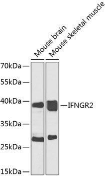 Western blot analysis of extracts of various cell lines, using IFNGR2 antibody  at 1:1000 dilution._Secondary antibody: HRP Goat Anti-Rabbit IgG   at 1:10000 dilution._Lysates/proteins: 25ug per lane._Blocking buffer: 3% nonfat dry milk in TBST._Detection: ECL Enhanced Kit ._Exposure time: 30s.