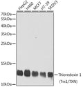 Western blot analysis of extracts of various cell lines, using Thioredoxin 1 ) antibody  at 1:1000 dilution.
Secondary…