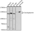 Western blot analysis of extracts of various cell lines, using Ceruloplasmin Antibody  at 1:1000 dilution.
Secondary antibody: HRP Goat Anti-Rabbit IgG   at 1:10000 dilution.
Lysates/proteins: 25ug per lane.
Blocking buffer: 3% nonfat dry milk in TBST.
Detection: ECL Basic Kit .
Exposure time: 90s.