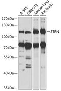 Western blot analysis of extracts of various cells, using STRN antibody.