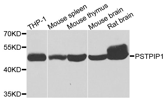 Western blot analysis of extracts of various cells, using PSTPIP1 antibody.