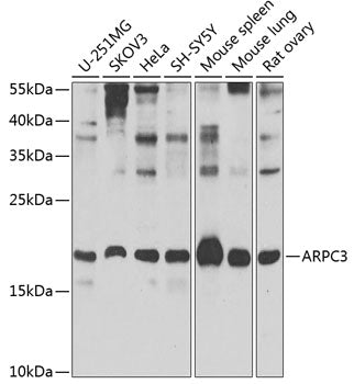 ARPC3 polyclonal antibody – Figure 1 of 2