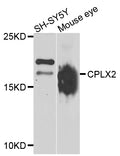 Western blot analysis of extracts of various cell lines, using CPLX2 antibody.