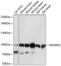 Western blot analysis of extracts of various cell lines, using ADAM22 antibody  at 1:1000 dilution.
Secondary antibody: HRP Goat Anti-Rabbit IgG   at 1:10000 dilution.
Lysates/proteins: 25ug per lane.
Blocking buffer: 3% nonfat dry milk in TBST.
Detection: ECL Basic Kit .
Exposure time: 1s.